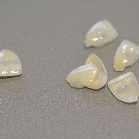 Veneers